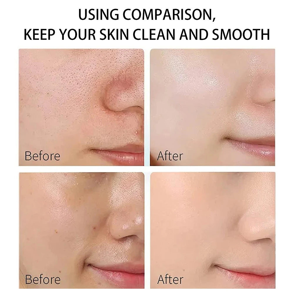 Mascarilla facial de barro de arcilla con ácido hialurónico, vitamina E, ilumina el tono de la piel, limpia profundamente, hidrata la piel, suaviza la piel