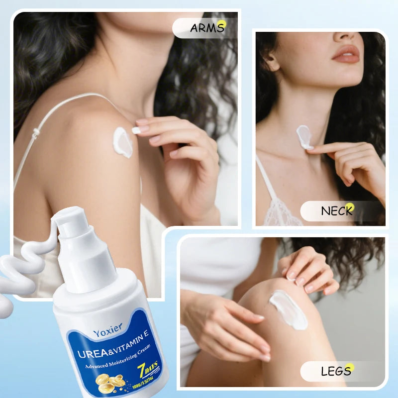 Crema hidratante reparadora de urea, queratosis, Pilaris, eliminación de pollo, limpieza de la piel y manchas de acné 100g