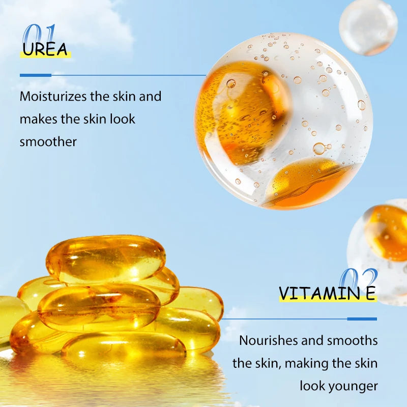 Crema hidratante reparadora de urea, queratosis, Pilaris, eliminación de pollo, limpieza de la piel y manchas de acné 100g