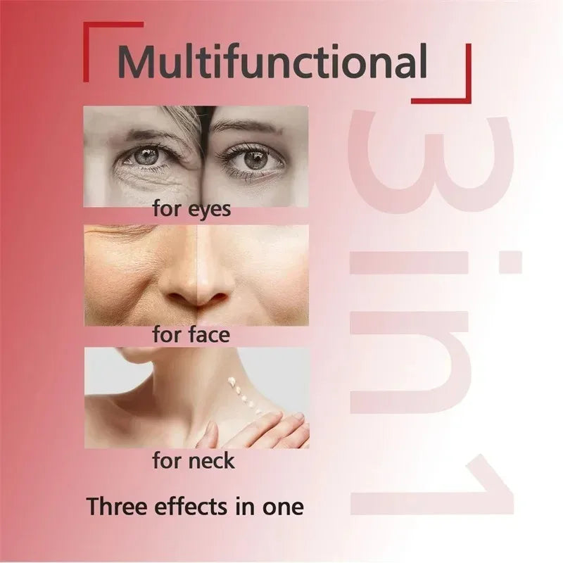 Crema blanqueadora facial y corporal con retinol, colágeno y ácido hialurónico 3 en 1, elimina manchas oscuras, melanina, acné y aclara la piel