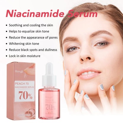 Serum facial de niacinamida, atenúa el melasma, corrige las manchas oscuras y reduce los poros, con acido hialurónico