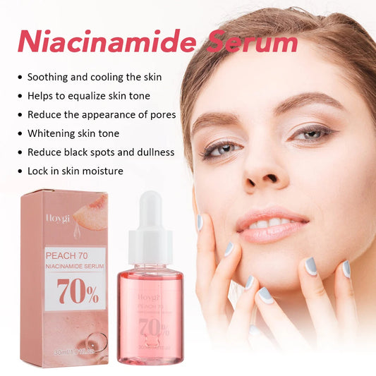 Serum facial de niacinamida, atenúa el melasma, corrige las manchas oscuras y reduce los poros, con acido hialurónico
