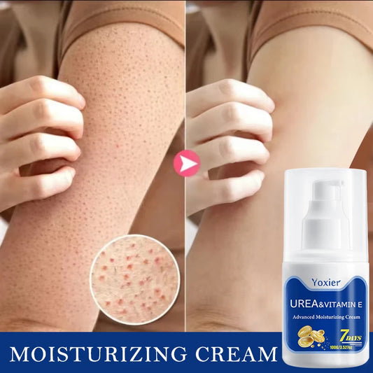 Crema hidratante reparadora de urea, queratosis, Pilaris, eliminación de pollo, limpieza de la piel y manchas de acné 100g