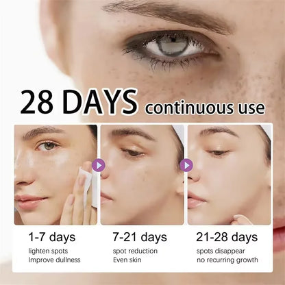 Serum eliminador de manchas oscuras, blanqueador, corrección de melanina y antipigmentación