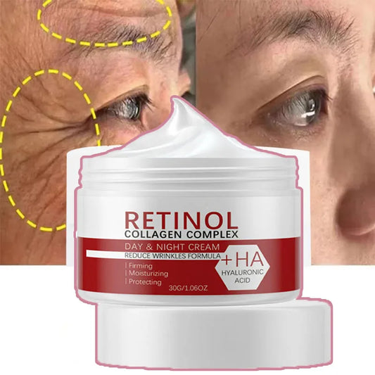 Crema blanqueadora facial y corporal con retinol, colágeno y ácido hialurónico 3 en 1, elimina manchas oscuras, melanina, acné y aclara la piel